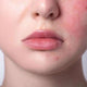 Cosmética Coreana Premium > Piel sensible y rojeces
